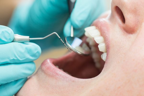 Close up of dentist holding angled mirror and hook while examining patient. Young woman is with mouth open getting dental checkup in hospital.